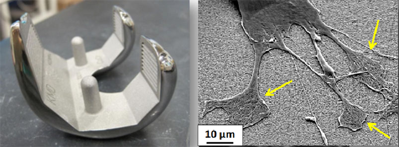 nano-coating-on-medical-implant.png