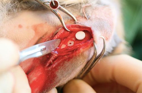 Surgical operation showing incision and implant